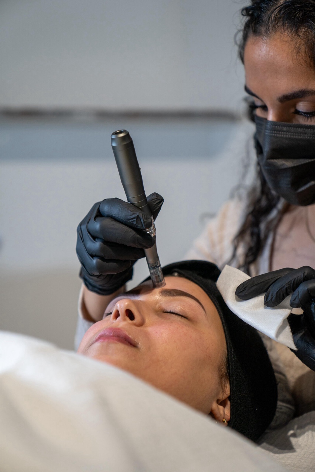 Soin microneedling en cours sur le front d'une cliente